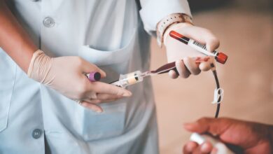 علاج فقر الدم..كيف تزيد من مستويات الحديد في الجسم؟