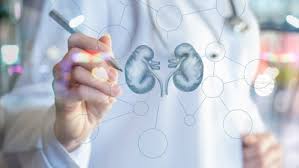 ثورة طبية.. الذكاء الاصطناعي يكشف سرطان الكلى في وقت قياسي