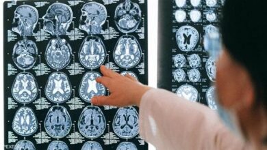 كيف نميز النسيان الطبيعي عن الخرف ؟