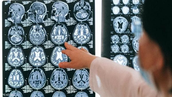 كيف نميز النسيان الطبيعي عن الخرف ؟