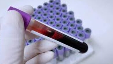 “اختراق علمي”.. اختبار دم في المنزل قد يكشف ألزهايمر