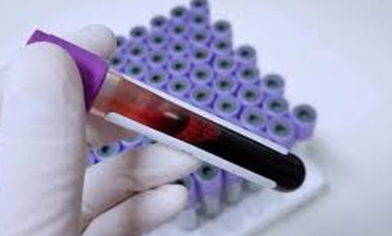 “اختراق علمي”.. اختبار دم في المنزل قد يكشف ألزهايمر