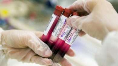 اختبار دم جديد قد يرفع نسب التعافي من سرطان فتاك