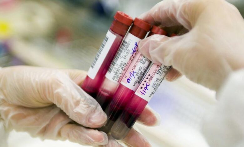 اختبار دم جديد قد يرفع نسب التعافي من سرطان فتاك