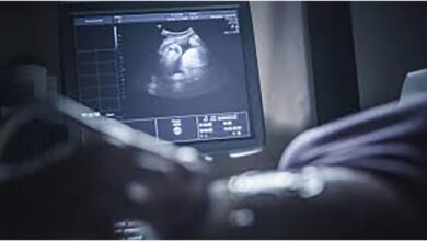 ذكاء اصطناعي جديد يتنبأ بمضاعفات خطيرة في الحمل بدقة عالية